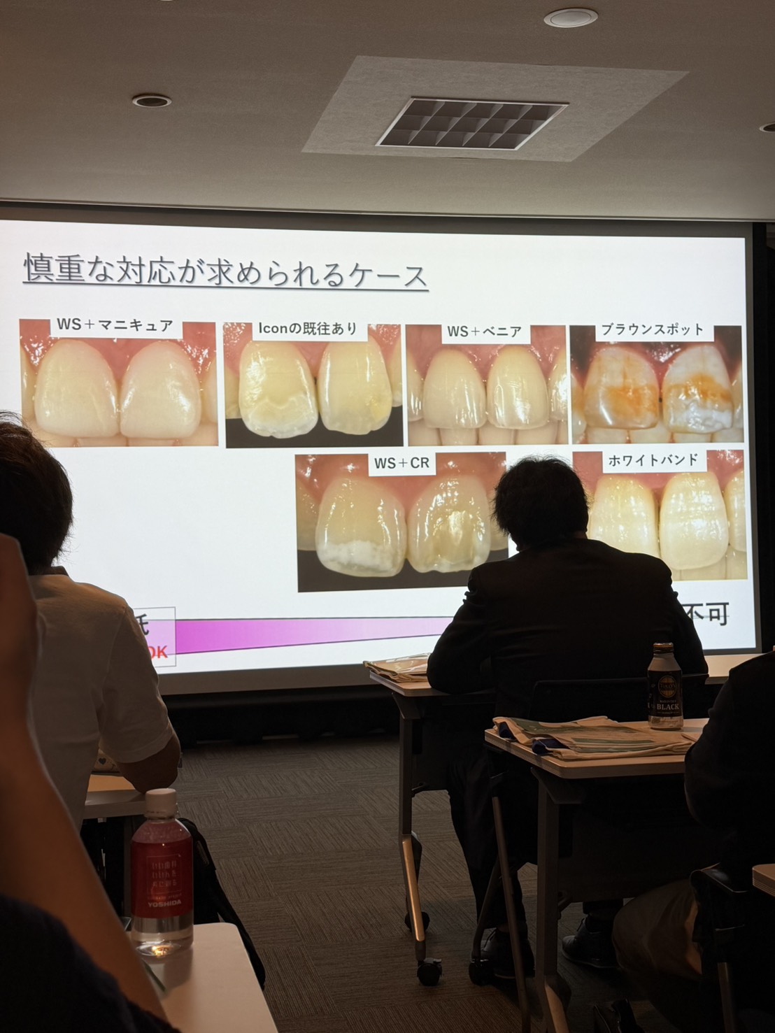 ホワイトスポット治療「アイコン」の講習会・ハンズオンセミナーに参加しました