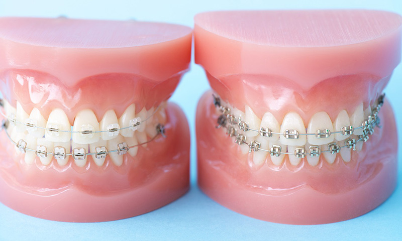 北山歯科クリニックの矯正歯科の特徴