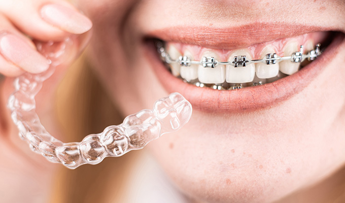 矯正中・敏感な方でも受けやすい